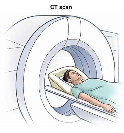 Male patient lying on back on CT scanner table is about to move into circular opening of CT scanner.