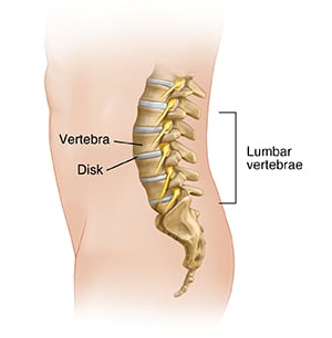 Side view of person showing lumbar spine anatomy, including vertebrae and discs.
