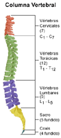 Ilustración de hernia de disco intervertebral